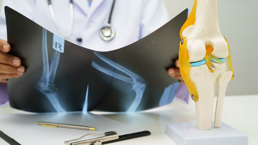 Chirurgien orthopédiste analysant IRM du genou sur écran médical