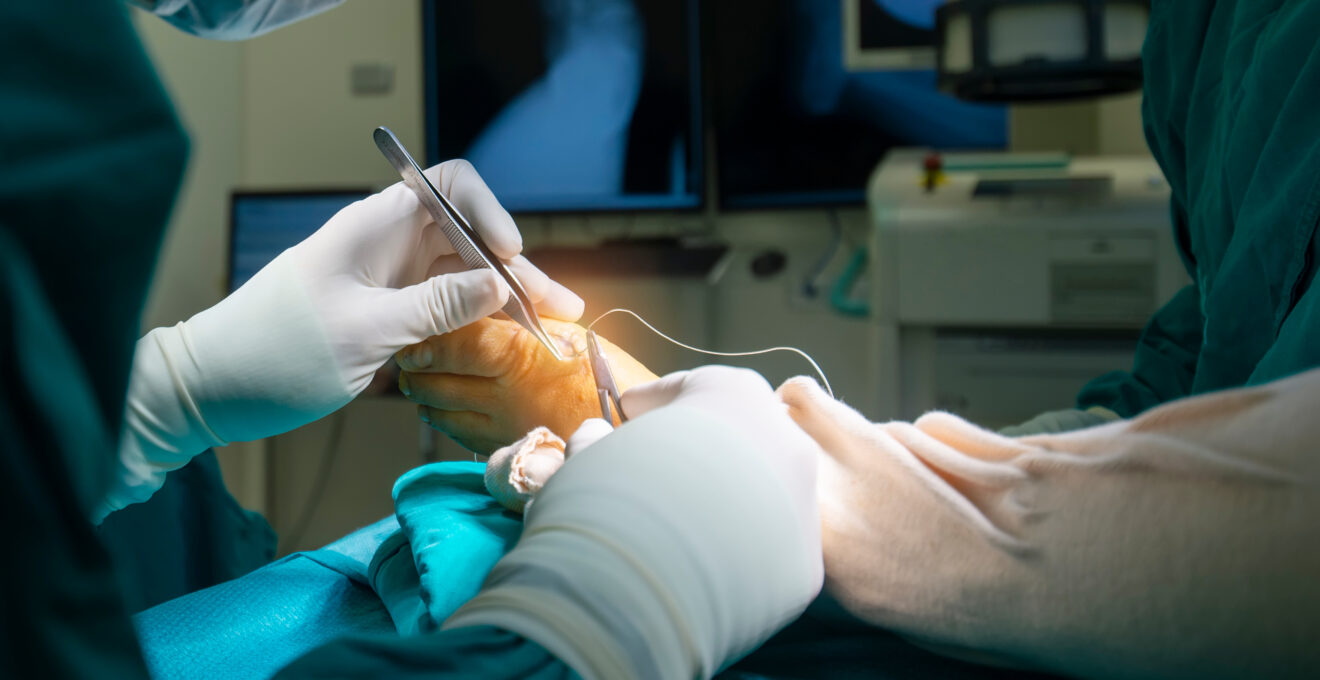 chirurgie de l’avant-pied