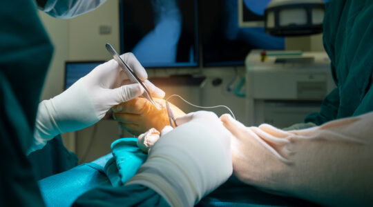 chirurgie de l’avant-pied